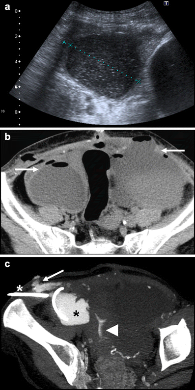 Fig. 12