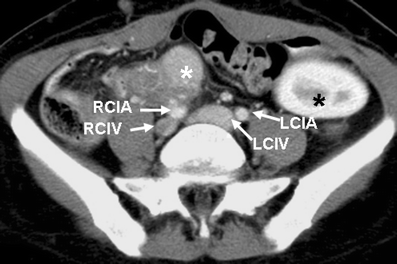 Fig. 18