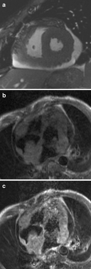 Fig. 10a–c