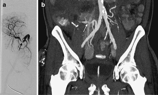 Fig. 9