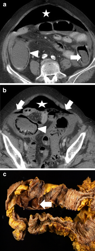 Fig. 12