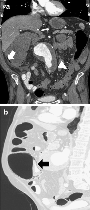 Fig. 4