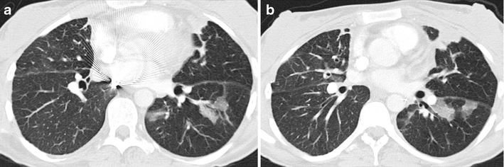 Fig. 14