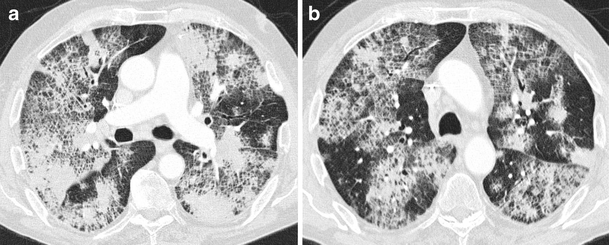 Fig. 15