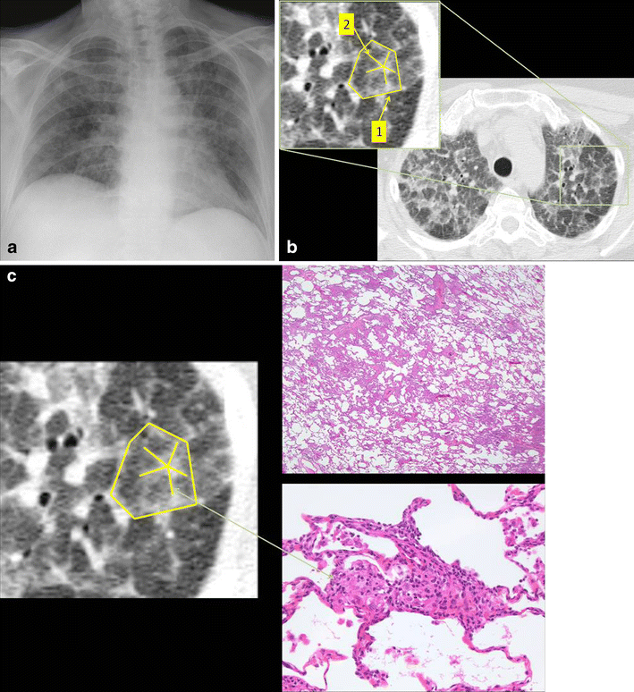 Fig. 3