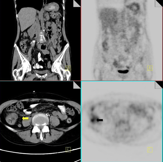 Fig. 11