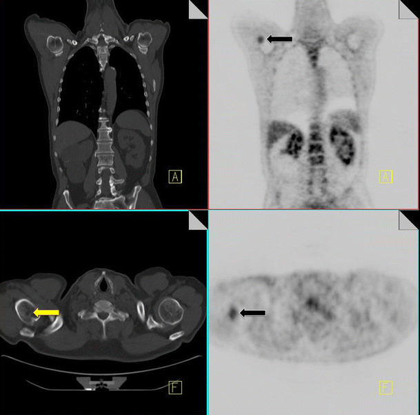 Fig. 13