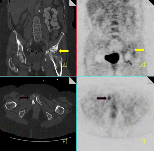 Fig. 14