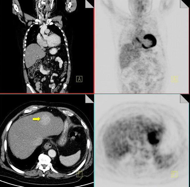 Fig. 16