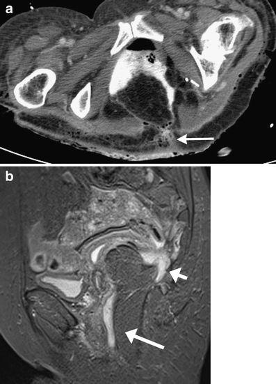 Fig. 13