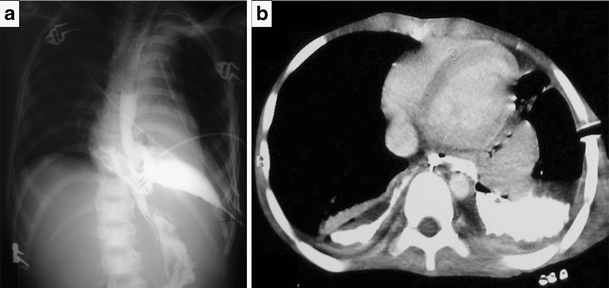 Fig. 12