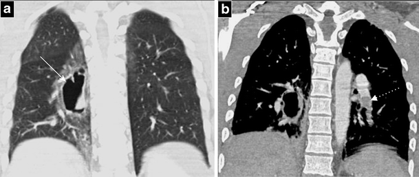 Fig. 5