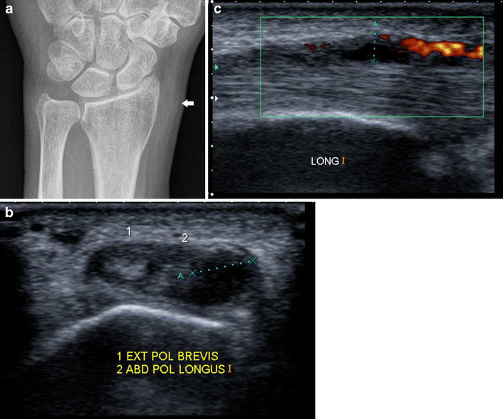 Fig. 10