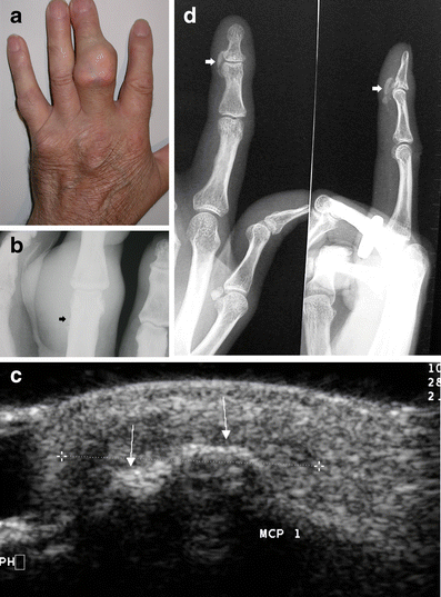 Fig. 17