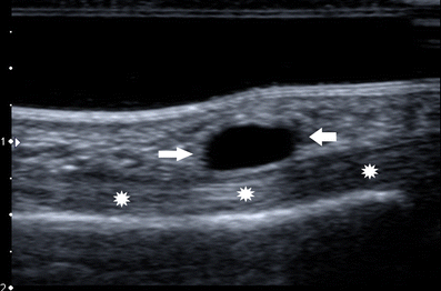 Fig. 5