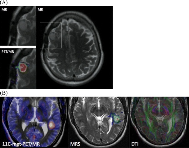 Fig. 4