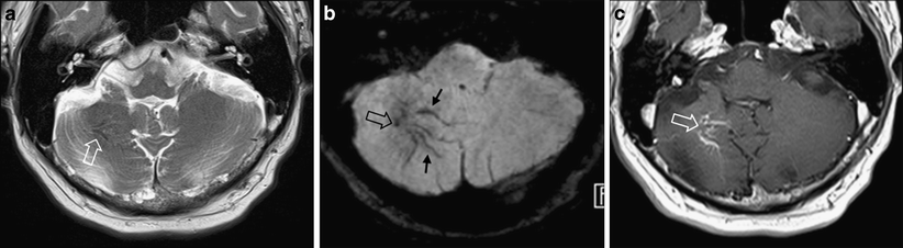 Fig. 10