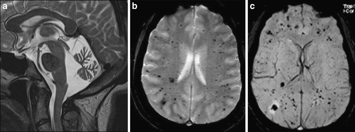 Fig. 12