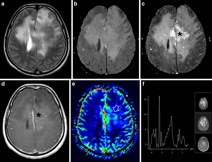 Fig. 14