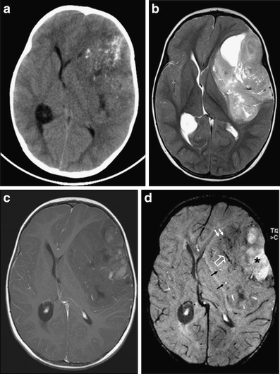 Fig. 15