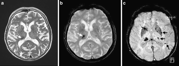 Fig. 3