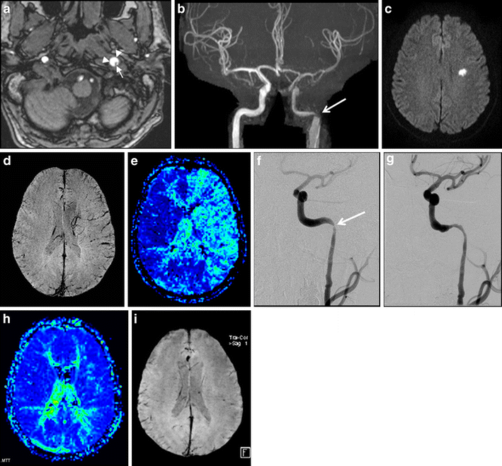 Fig. 5