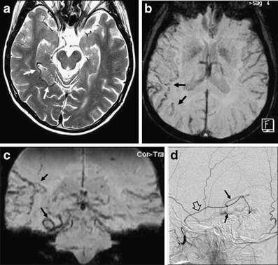 Fig. 8