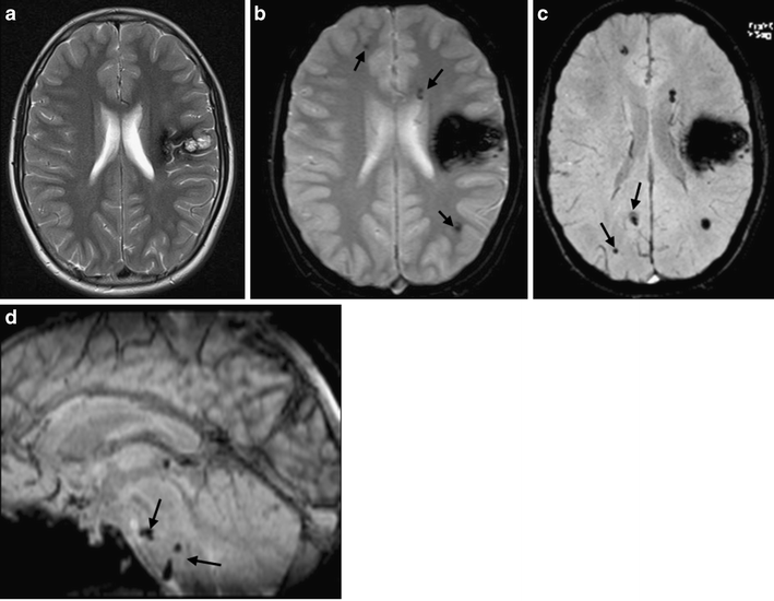 Fig. 9