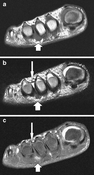 Fig. 5