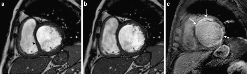 Fig. 10