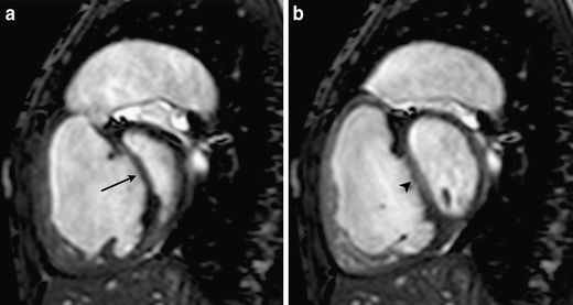 Fig. 6