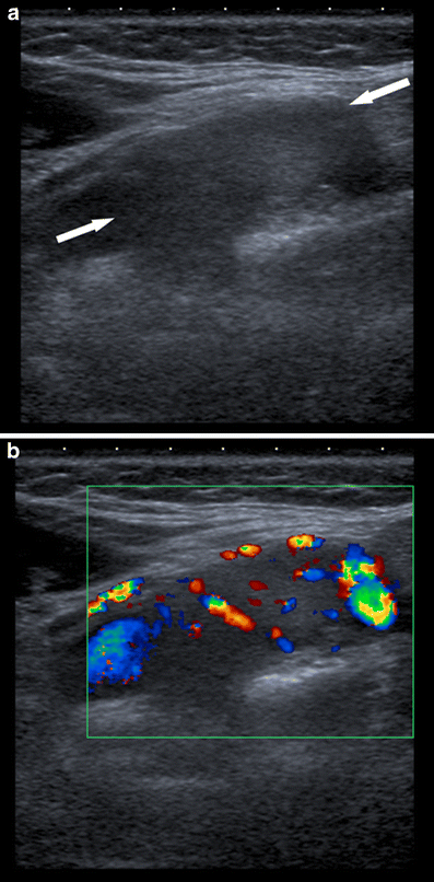 Fig. 1