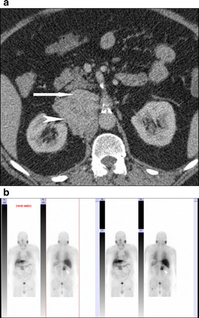 Fig. 4