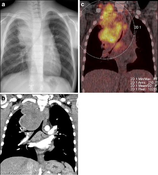 Fig. 14