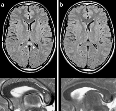 Fig. 12