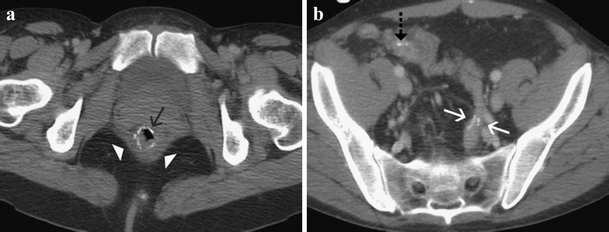 Fig. 13