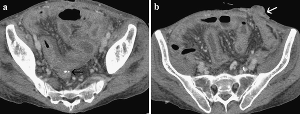 Fig. 15