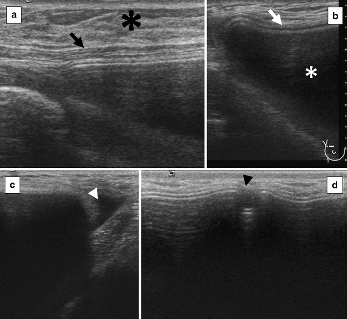 Fig. 18