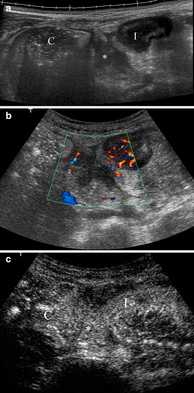 Fig. 11