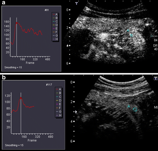 Fig. 16