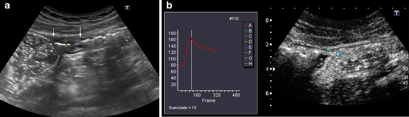 Fig. 18