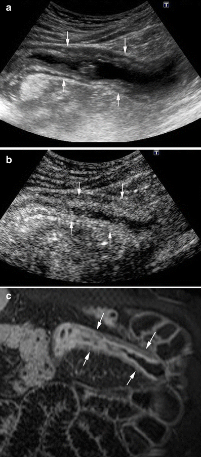 Fig. 5