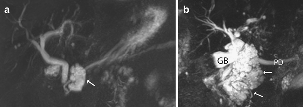 Fig. 15