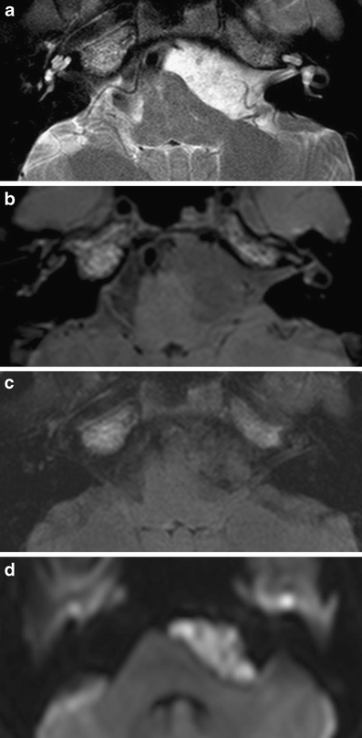 Fig. 16