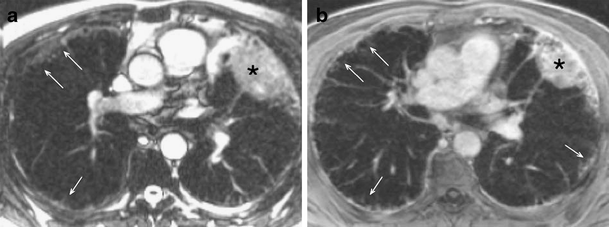 Fig. 7