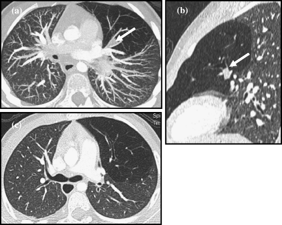 Fig. 13