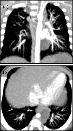 Fig. 14