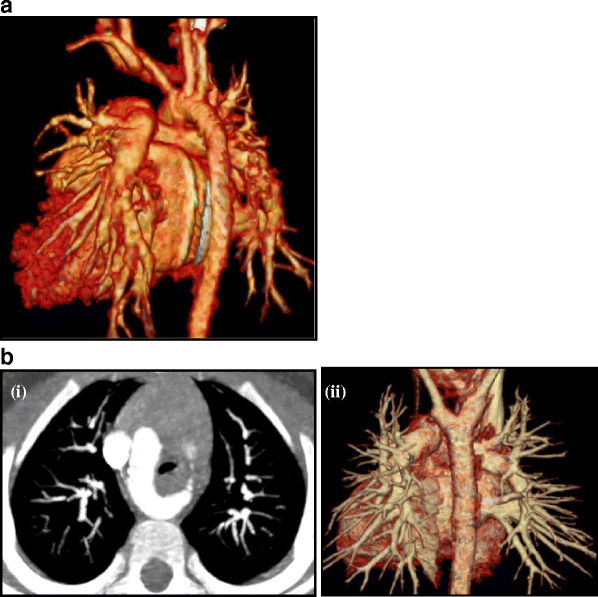 Fig. 19