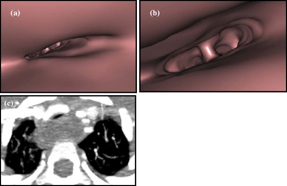 Fig. 5