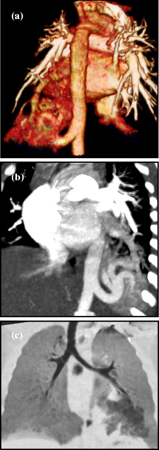 Fig. 9